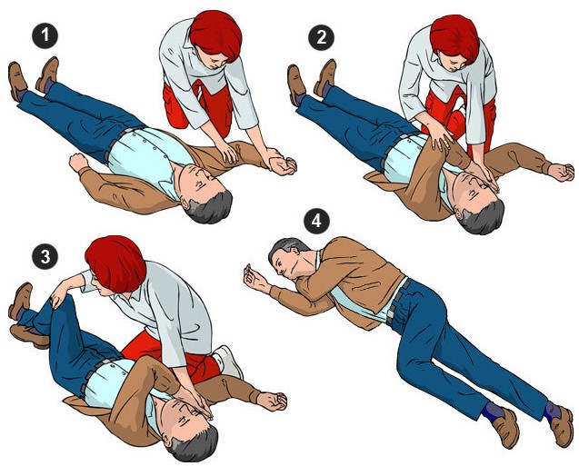 реанимация